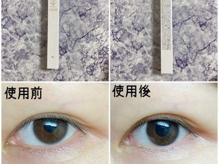 アイアクト,口コミ,アットコスメ