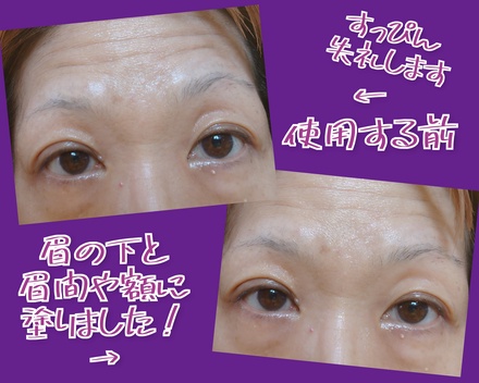 アイアクト,口コミ,アットコスメ