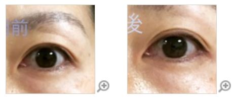 アイアクト,口コミ,アットコスメ